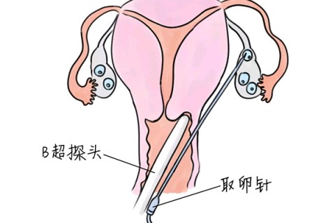 http://tianjin.vdtfzz.com/post/205.html|天津供卵助孕